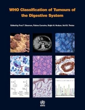 WHO Classification of Tumours of the Digestive System 4th Edition