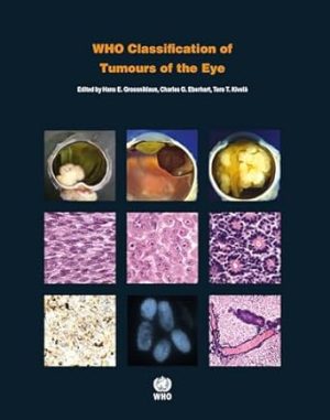 WHO Classification of Tumours of the Eye 4th Edition