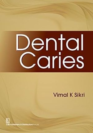 DENTAL CARIES