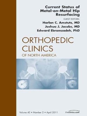 Current Status of Metal on Metal Hip Resurfacing An Issue of Orthopedic Clinics Number 2