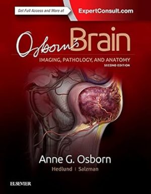 Osborns Brain 2nd Edition