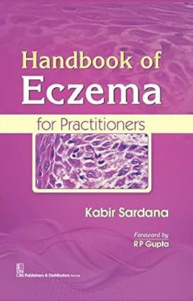 Handbook of Eczema for Practitioners