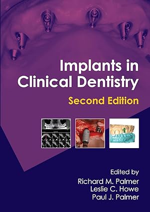 Implants in Clinical Dentistry 2nd Edition