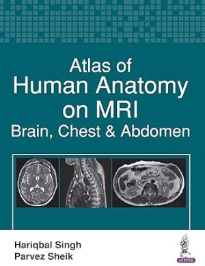 Atlas of Human Anatomy on MRI Brain Chest & Abdomen