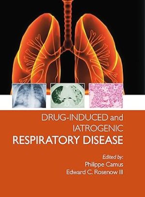 Drug induced and Iatrogenic Respiratory Disease