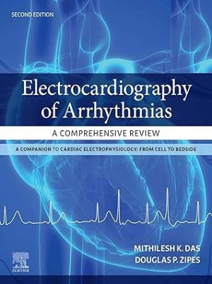 Electrocardiography of Arrhythmias A Comprehensive Review 2nd Edition