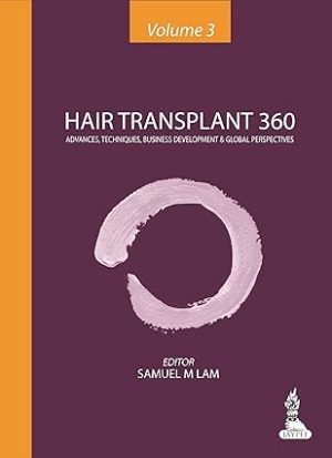Hair Transplant 360 Advances Techniques Business Development and Global Perspectives