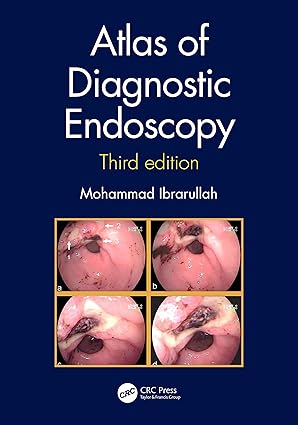 Atlas of Diagnostic Endoscopy 3rd Edition