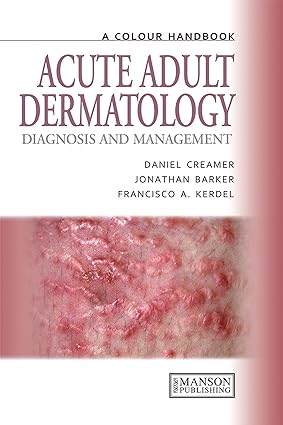 Acute Adult Dermatology Diagnosis and Management A Colour Handbook