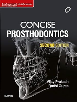 Concise Prosthodontics 2nd Edition