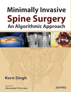 Minimally Invasive Spine Surgery An Algorithmic Approach