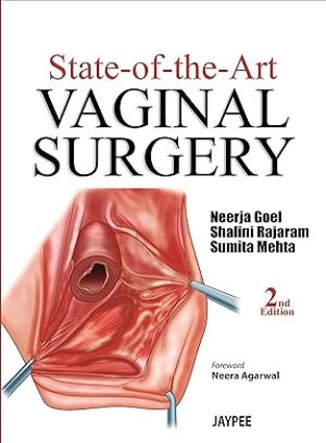 State of the Art Vaginal Surgery 2nd Edition