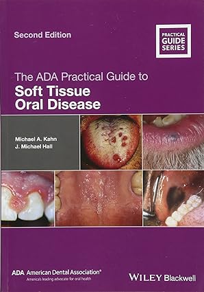 The ADA Practical Guide to Soft Tissue Oral Disease 2nd Edition