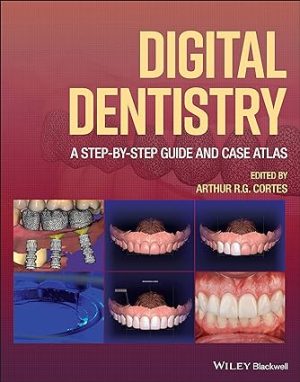 Digital Dentistry A Step by Step Guide and Case Atlas