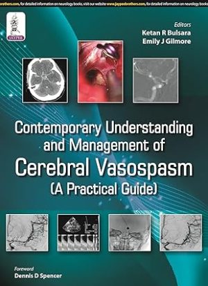 Contemporary Understanding and Management of Cerebral Vasospasm A Practical Guide