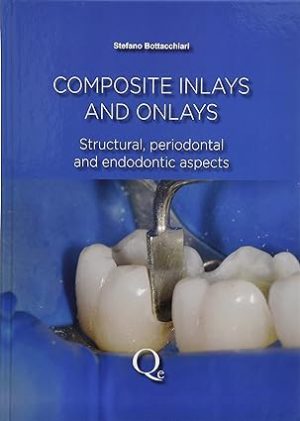 Composite Inlays and Onlays Structural Periodontal and Endodontic Aspects