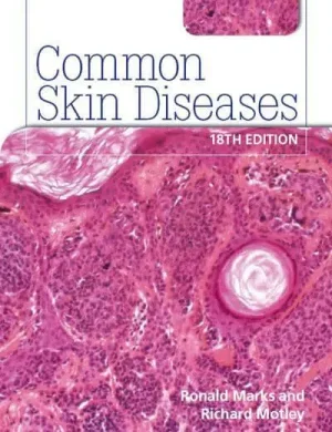 Common Skin Diseases 18th Edition
