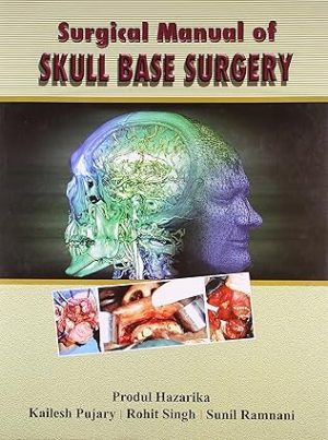 Surgical Manual Of Skull Base Surgery