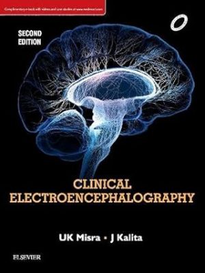 Clinical Electroencephalography 2nd Edition