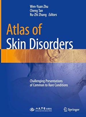 Atlas of Skin Disorders Challenging Presentations of Common to Rare Conditions