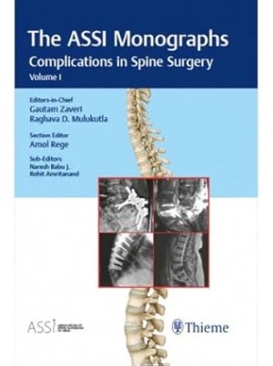 Association of Spine Surgeons of India ASSI Monograph Series Complications in Spine Surgery Volume 1