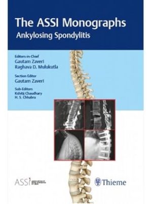 Association of Spine Surgeons of India ASSI Monograph Series: Ankylosing Spondylitis