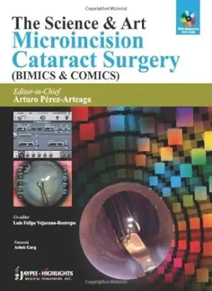 The Science and Art Microincision Cataract Surgery