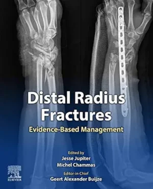 Distal Radius Fractures Evidence Based Management