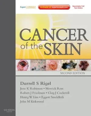 Cancer of the Skin 2nd Edition