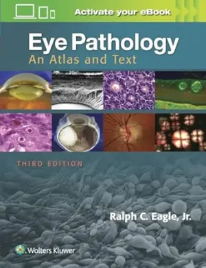 Eye Pathology An Atlas and Text 3rd Edition