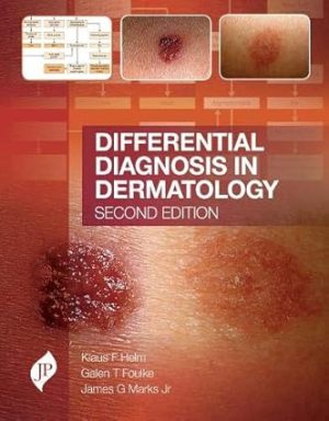 Differential Diagnosis in Dermatology 2nd Edition