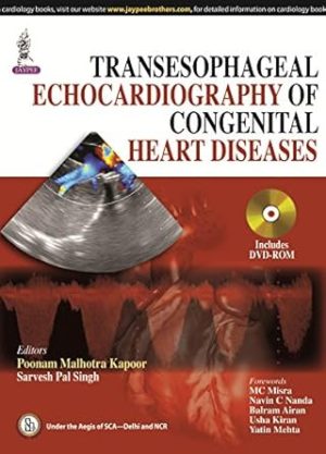 Transesophageal Echocardiography of Congenital Heart Diseases
