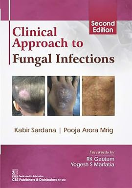 Clinical Approach to Fungal Infections 2nd Edition