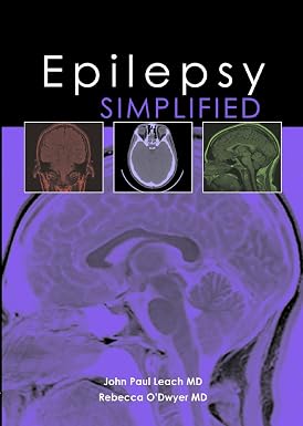 Epilepsy Simplified