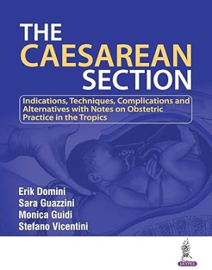 The Caesarean Section
