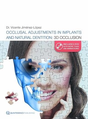 Occlusal Adjustments in Implants and Natural Dentition 3D Occlusion