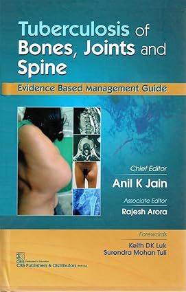 Tuberculosis of Bones Joints and Spine Evidence Based Management Guide
