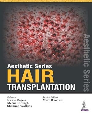 Aesthetic Series Hair Transplantation