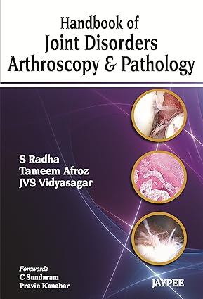 Handbook of Joint Disorders Arthroscopy and Pathology