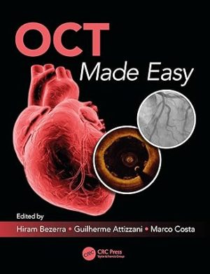 OCT Made Easy