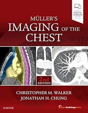 Mullers Imaging of the Chest Expert Radiology Series 2nd Edition