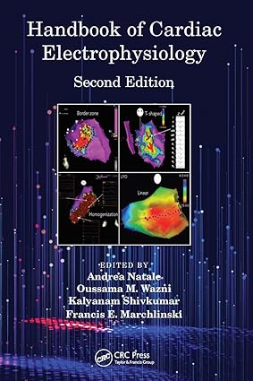 Handbook of Cardiac Electrophysiology 2nd Edition
