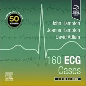 160 ECG Cases 6th Edition