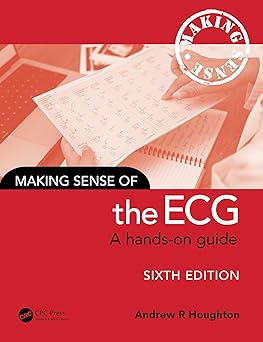 Making Sense of the ECG A Hands On Guide
