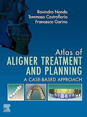Atlas of Aligner Treatment and Planning E BOOK