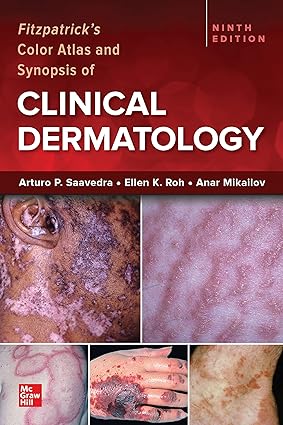 FITZPATRICKS COLOR ATLAS & SYNOPSIS OF CLINICAL DERMA 9th Edition